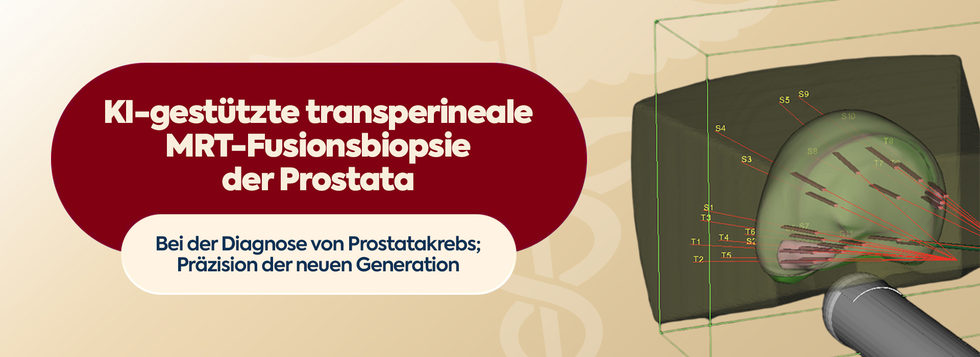 volkanizol_banner_transperineal_tr